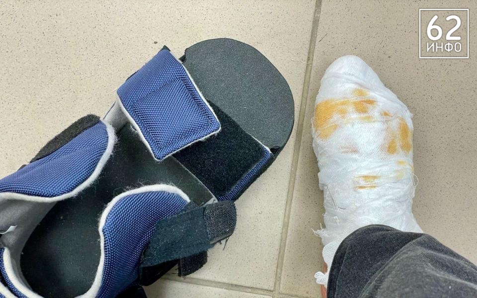 Рязанцы обращались в БСМП из-за переломов и других травм 618 раз за неделю - 62ИНФО Рязанцы обращались в БСМП из-за переломов и других травм 618 раз за неделю - 62ИНФО