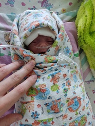 В Рязани выходили самую маленькую в истории Перинатального центра девочку весом 450 граммов 