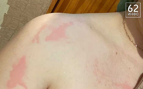 Рязанцев атакуют полчища комаров и мошки