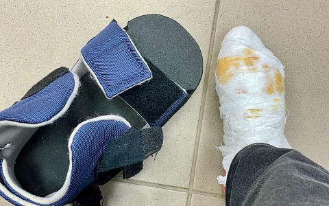 БСМП отметило снижение травматизма в новогодние выходные