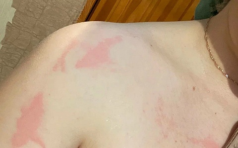 Рязанцев атакуют кровососы: эффективные народные средства от комаров